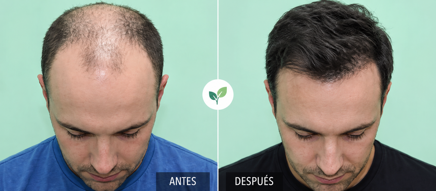 5 meses de uso